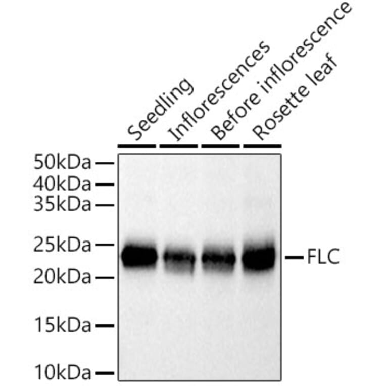 Western Blot - Anti-FLC Antibody (A305967) - Antibodies.com