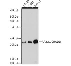 Western Blot - Anti-RAIDD Antibody [ARC1770] (A305968) - Antibodies.com