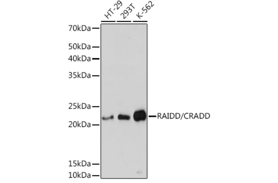 Western Blot - Anti-RAIDD Antibody [ARC1770] (A305968) - Antibodies.com