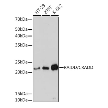 Western Blot - Anti-RAIDD Antibody [ARC1770] (A305968) - Antibodies.com