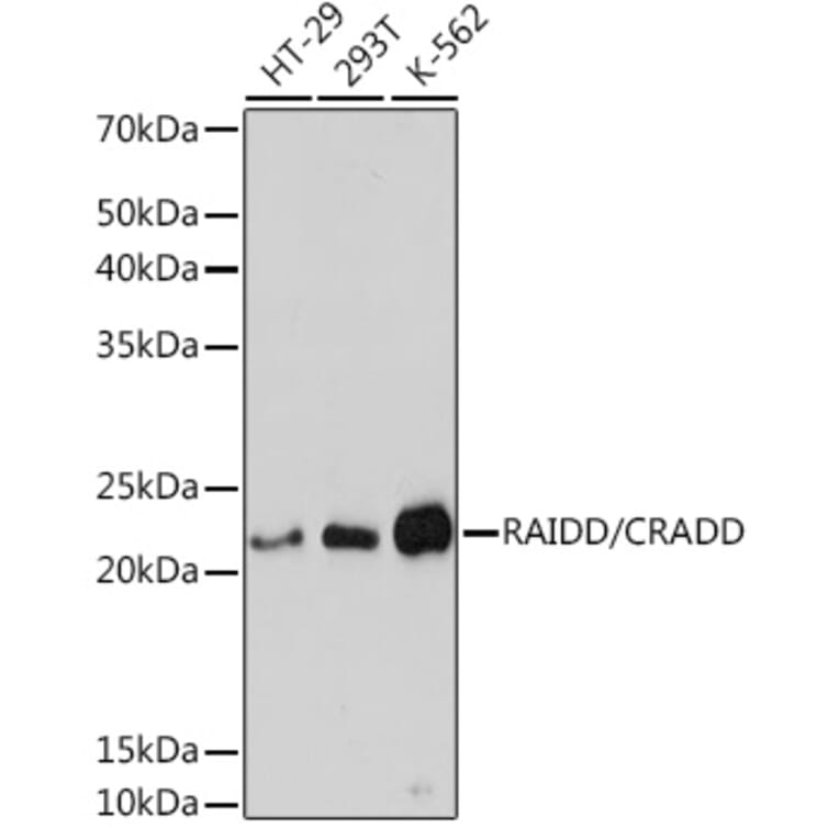 Western Blot - Anti-RAIDD Antibody [ARC1770] (A305968) - Antibodies.com