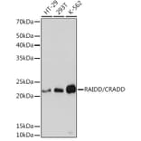 Western Blot - Anti-RAIDD Antibody [ARC1770] (A305968) - Antibodies.com