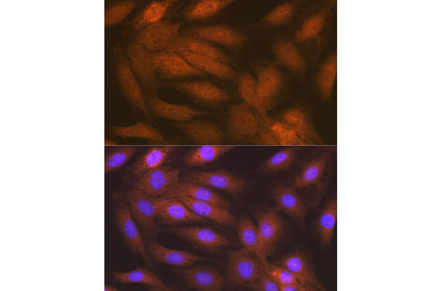 Immunofluorescence - Anti-RAIDD Antibody [ARC1770] (A305968) - Antibodies.com