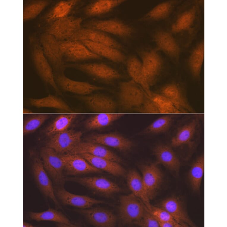Immunofluorescence - Anti-RAIDD Antibody [ARC1770] (A305968) - Antibodies.com