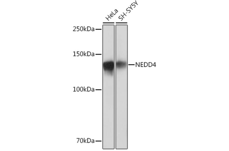 Western Blot - Anti-NEDD4 Antibody [ARC0992] (A305969) - Antibodies.com