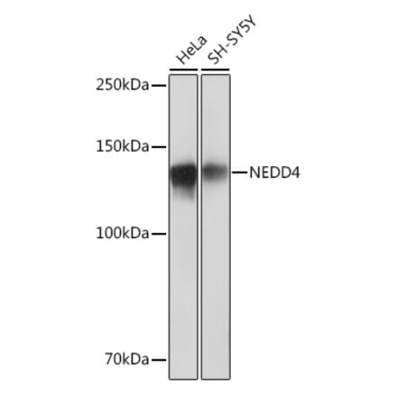 Western Blot - Anti-NEDD4 Antibody [ARC0992] (A305969) - Antibodies.com