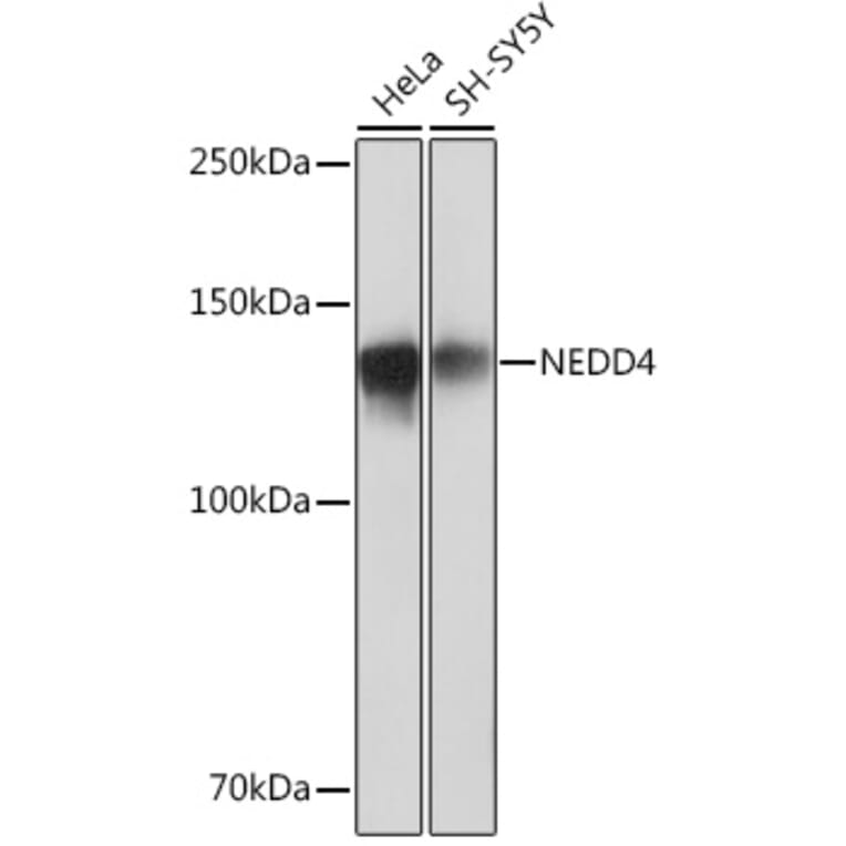 Western Blot - Anti-NEDD4 Antibody [ARC0992] (A305969) - Antibodies.com