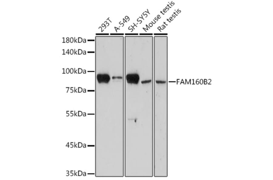 Western Blot - Anti-FHIP2B Antibody (A305971) - Antibodies.com