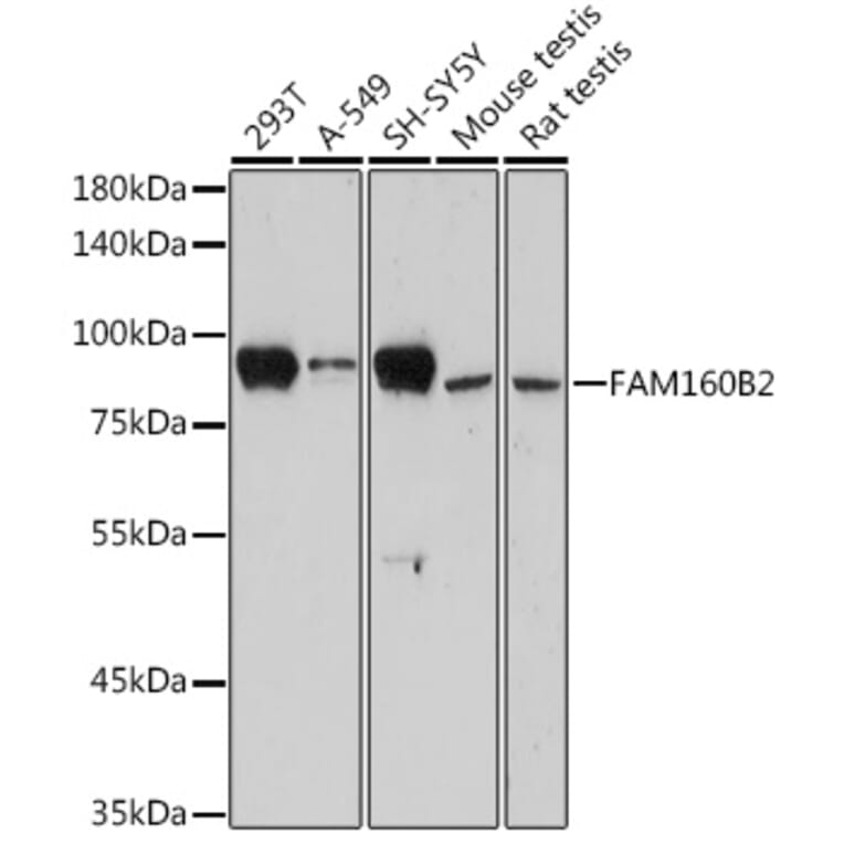 Western Blot - Anti-FHIP2B Antibody (A305971) - Antibodies.com