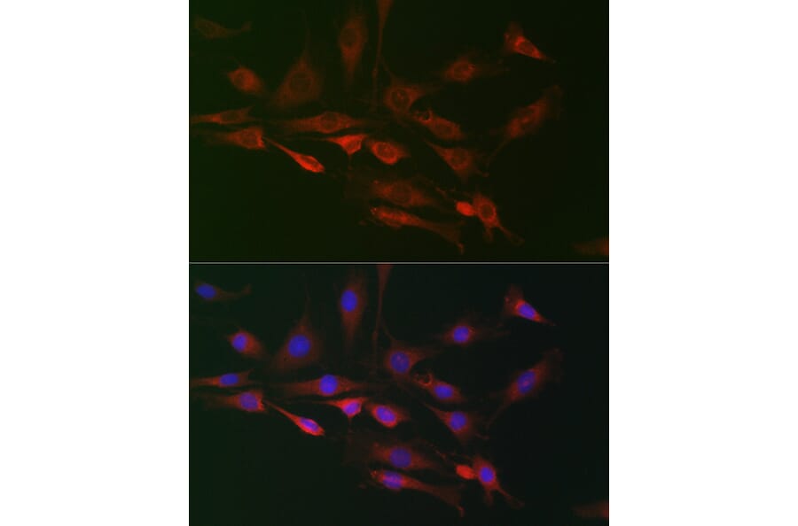 Immunofluorescence - Anti-FHIP2B Antibody (A305971) - Antibodies.com