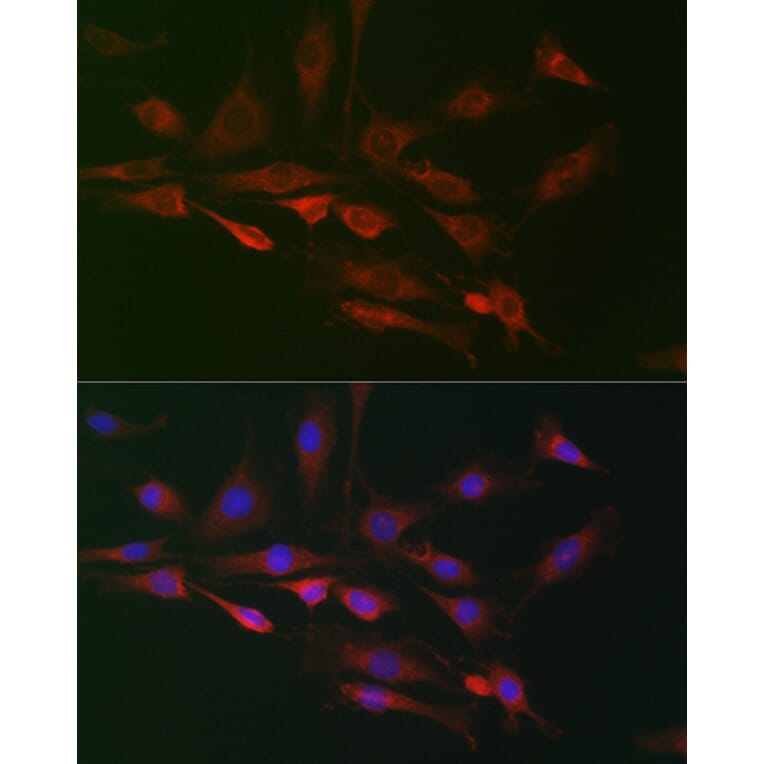 Immunofluorescence - Anti-FHIP2B Antibody (A305971) - Antibodies.com
