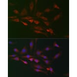 Immunofluorescence - Anti-FHIP2B Antibody (A305971) - Antibodies.com