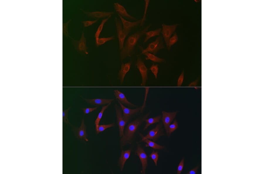 Immunofluorescence - Anti-FHIP2B Antibody (A305971) - Antibodies.com