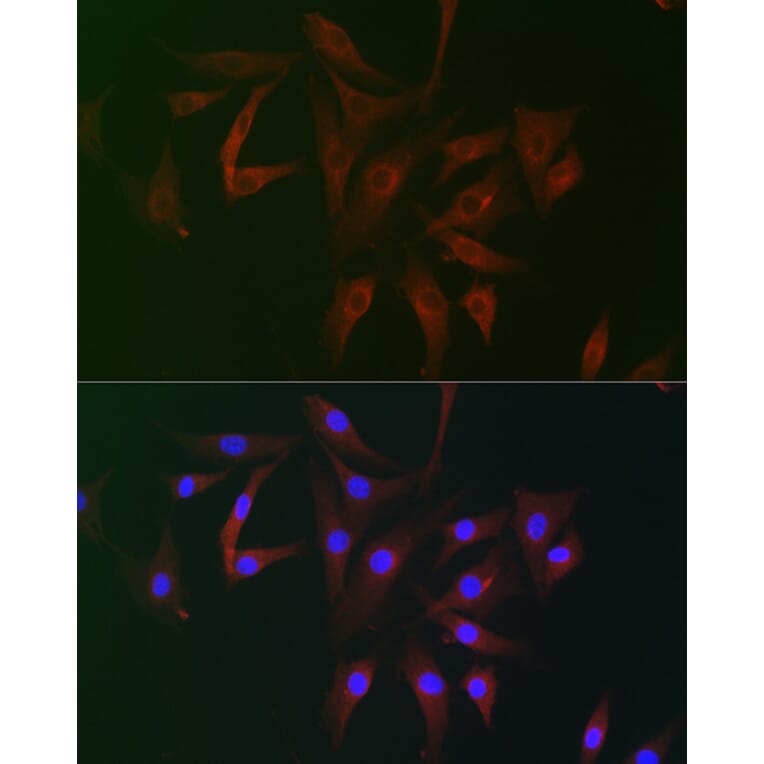 Immunofluorescence - Anti-FHIP2B Antibody (A305971) - Antibodies.com