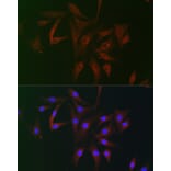 Immunofluorescence - Anti-FHIP2B Antibody (A305971) - Antibodies.com