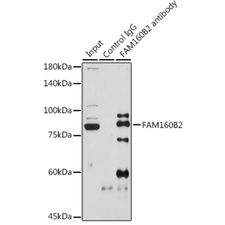 Western Blot - Anti-FHIP2B Antibody (A305971) - Antibodies.com