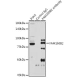 Western Blot - Anti-FHIP2B Antibody (A305971) - Antibodies.com