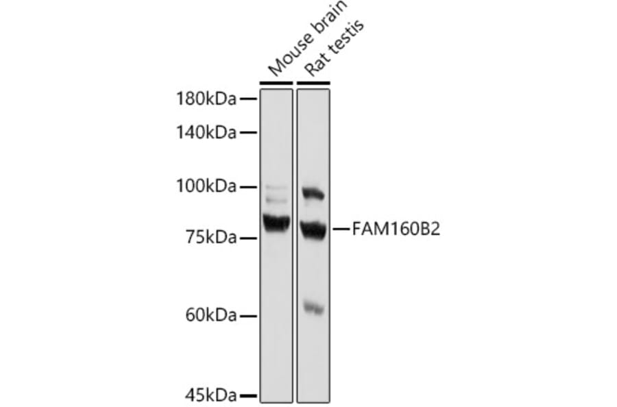 Western Blot - Anti-Fhip2b Antibody (A305973) - Antibodies.com