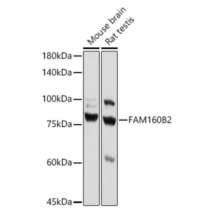Western Blot - Anti-Fhip2b Antibody (A305973) - Antibodies.com