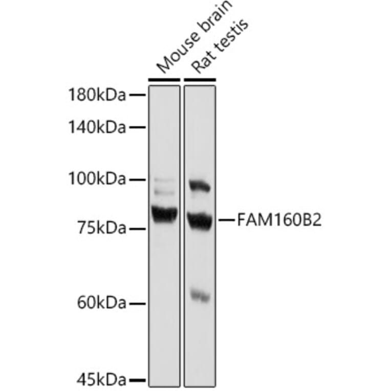 Western Blot - Anti-Fhip2b Antibody (A305973) - Antibodies.com