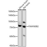 Western Blot - Anti-Fhip2b Antibody (A305973) - Antibodies.com
