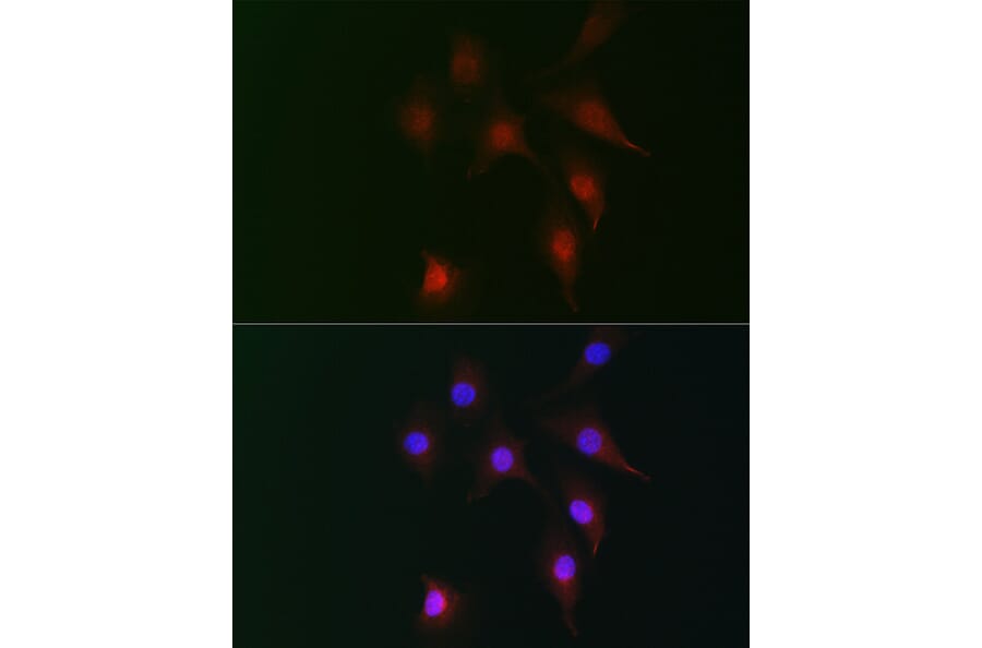 Immunofluorescence - Anti-Fhip2b Antibody (A305973) - Antibodies.com