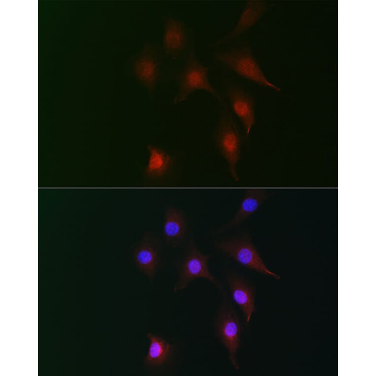 Immunofluorescence - Anti-Fhip2b Antibody (A305973) - Antibodies.com