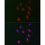 Immunofluorescence - Anti-Fhip2b Antibody (A305973) - Antibodies.com