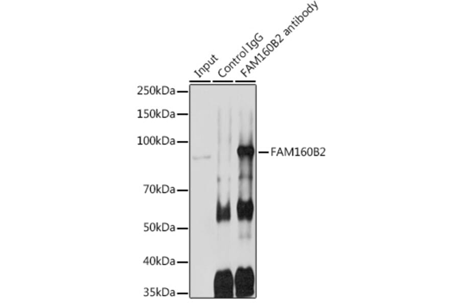 Western Blot - Anti-Fhip2b Antibody (A305973) - Antibodies.com