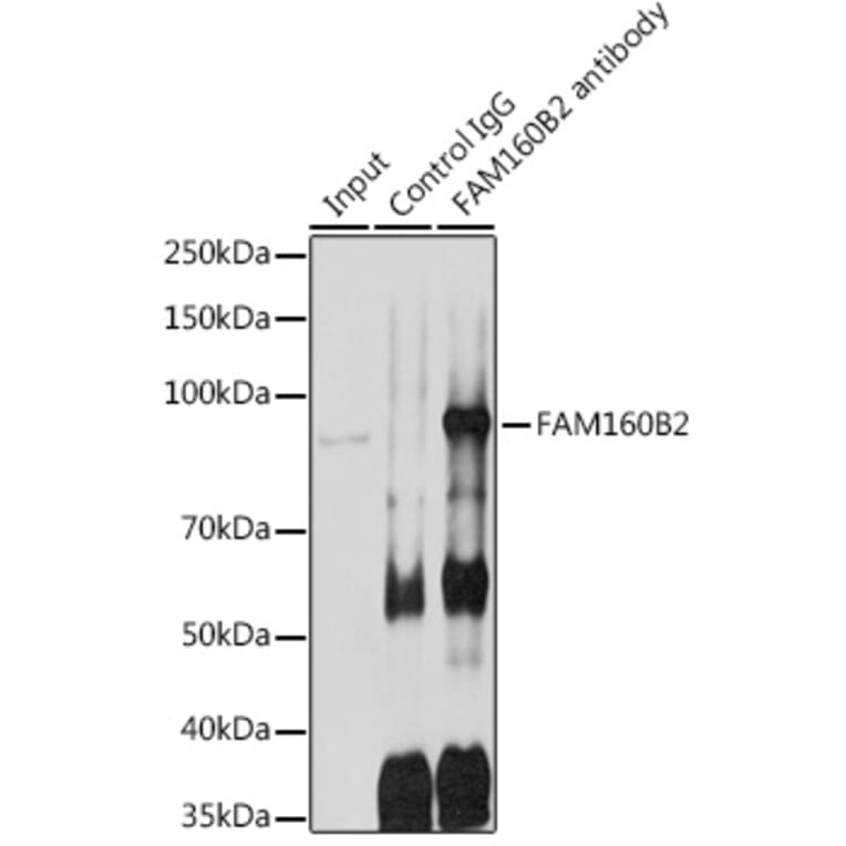 Western Blot - Anti-Fhip2b Antibody (A305973) - Antibodies.com