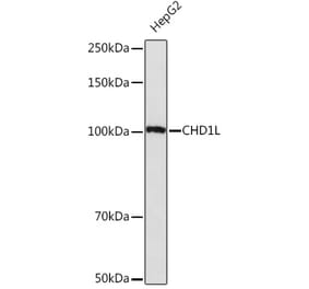 Western Blot - Anti-CHD1L Antibody [ARC2153] (A305974) - Antibodies.com