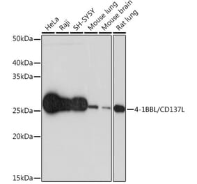 Western Blot - Anti-4-1BBL Antibody [ARC1963] (A305975) - Antibodies.com