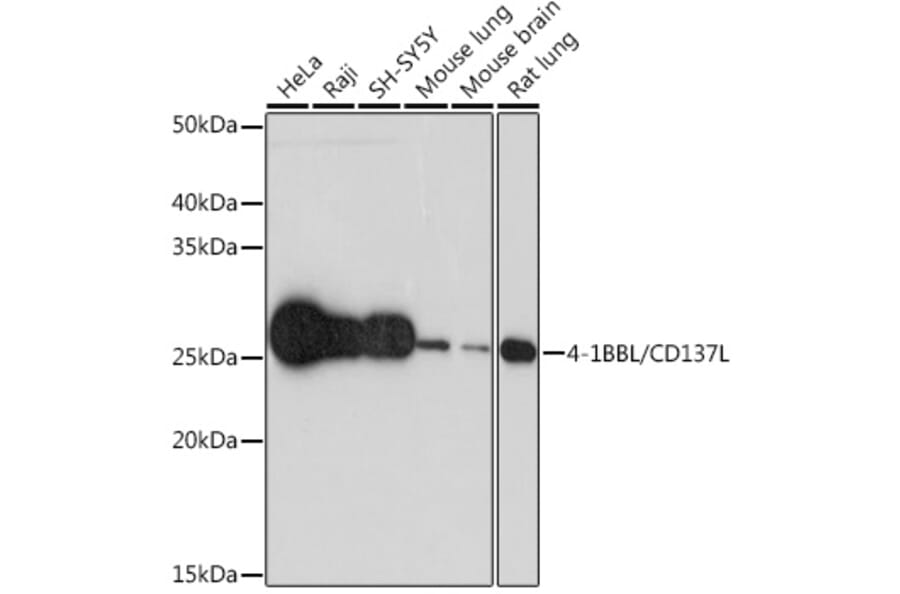 Western Blot - Anti-4-1BBL Antibody [ARC1963] (A305975) - Antibodies.com