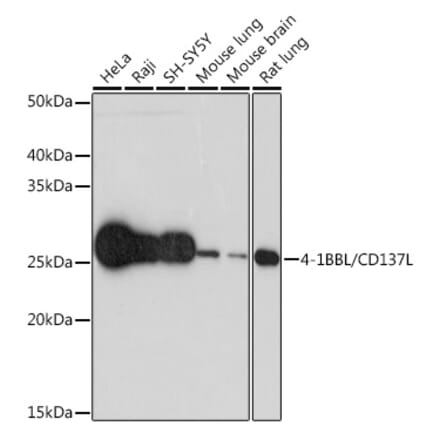 Western Blot - Anti-4-1BBL Antibody [ARC1963] (A305975) - Antibodies.com