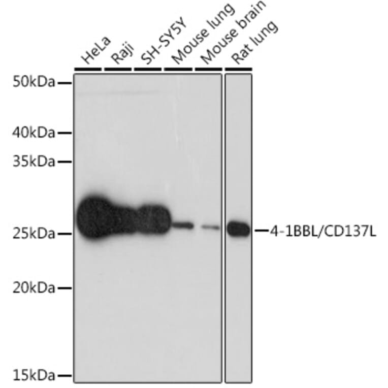 Western Blot - Anti-4-1BBL Antibody [ARC1963] (A305975) - Antibodies.com