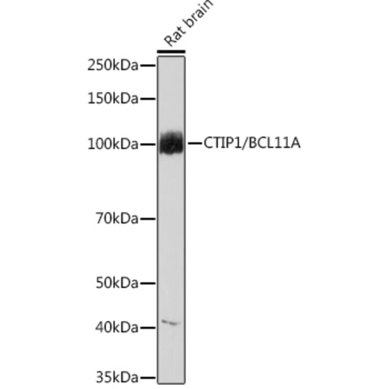 Western Blot - Anti-Ctip1/BCL-11A Antibody [ARC1486] (A305976) - Antibodies.com