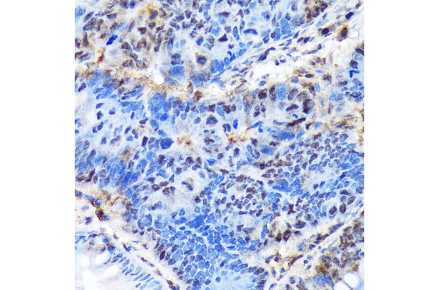 Immunohistochemistry - Anti-Ctip1/BCL-11A Antibody [ARC1486] (A305976) - Antibodies.com