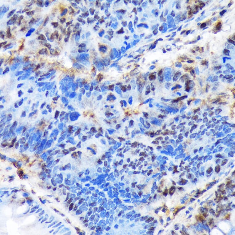 Immunohistochemistry - Anti-Ctip1/BCL-11A Antibody [ARC1486] (A305976) - Antibodies.com