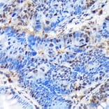 Immunohistochemistry - Anti-Ctip1/BCL-11A Antibody [ARC1486] (A305976) - Antibodies.com