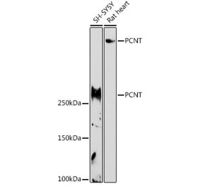 Western Blot - Anti-Pericentrin Antibody (A305977) - Antibodies.com