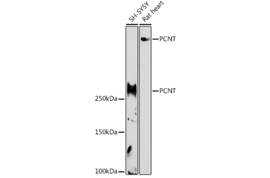 Western Blot - Anti-Pericentrin Antibody (A305977) - Antibodies.com