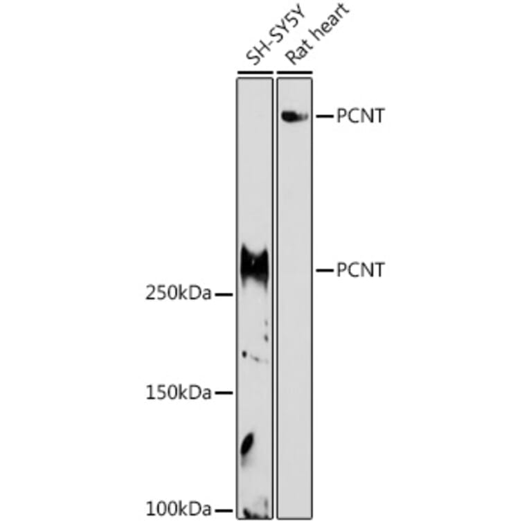 Western Blot - Anti-Pericentrin Antibody (A305977) - Antibodies.com