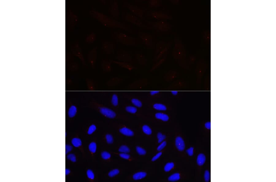Immunofluorescence - Anti-Pericentrin Antibody (A305977) - Antibodies.com