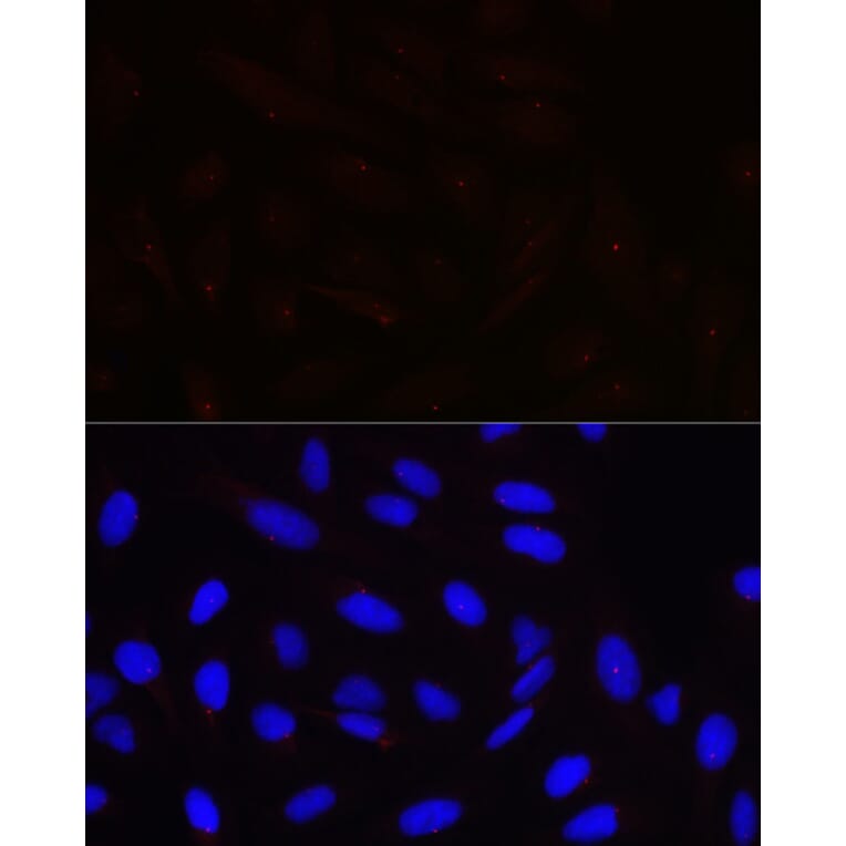 Immunofluorescence - Anti-Pericentrin Antibody (A305977) - Antibodies.com