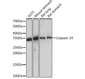 Western Blot - Anti-Caspase-14 Antibody [ARC1661] (A305978) - Antibodies.com