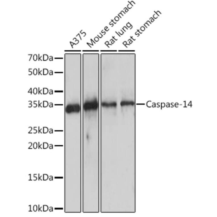 Western Blot - Anti-Caspase-14 Antibody [ARC1661] (A305978) - Antibodies.com