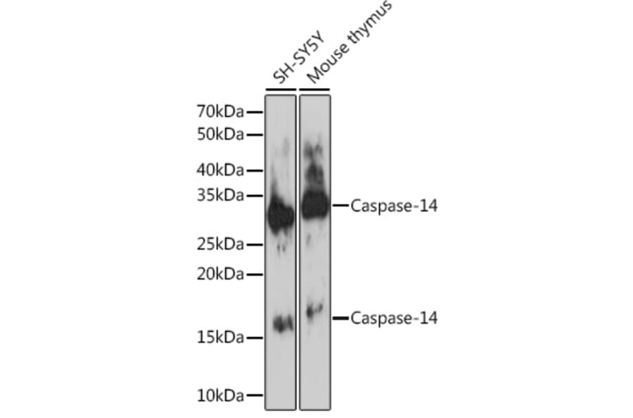 Western Blot - Anti-Caspase-14 Antibody [ARC1661] (A305978) - Antibodies.com