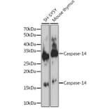 Western Blot - Anti-Caspase-14 Antibody [ARC1661] (A305978) - Antibodies.com