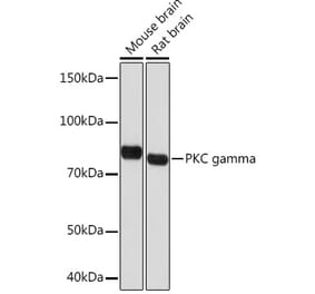 Western Blot - Anti-PKC gamma Antibody [ARC1637] (A305980) - Antibodies.com
