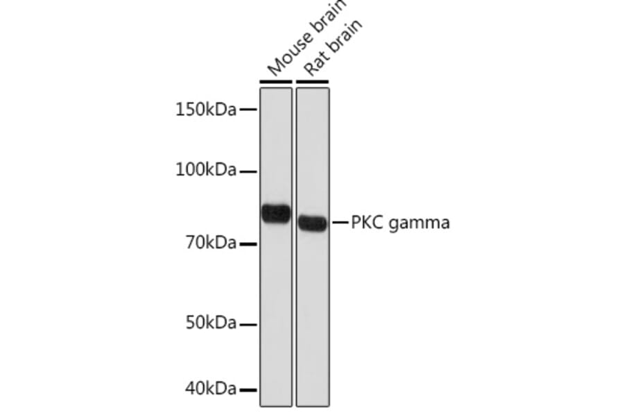 Western Blot - Anti-PKC gamma Antibody [ARC1637] (A305980) - Antibodies.com